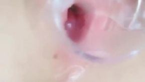 [Zone vidéo courte] Regardez les points d'acupuncture