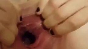 [短视频区] 扩大