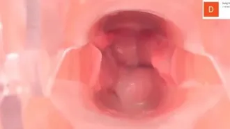 Seltene Ressourcen: Ein hochauflösendes Endoskop, das das Innere der Vagina einer Frau zeigt und aus einem Schönheits- und Bodybuilding-Krankenhaus stammt