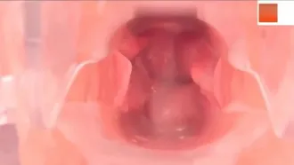 Recursos raros vazados de um hospital de beleza e fisiculturismo A endoscopia de alta definição mostra os movimentos internos das vaginas das mulheres. As mudanças são tão rosadas e sensíveis.