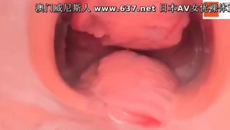 Recursos raros: un endoscopio de alta definición que muestra el interior de la vagina de una mujer filtrado de un hospital de belleza y culturismo